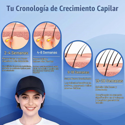 KAPILUME — Gorro de Luz Roja LED para el Cuidado Capilar